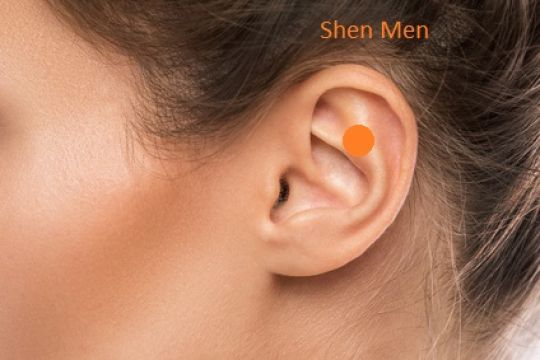Darstellung des Akupressurpunktes Shen Men in einer Ohrmuschel.
